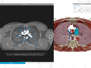 Human Anatomy Atlas 2020: Complete 3D Human Body 17